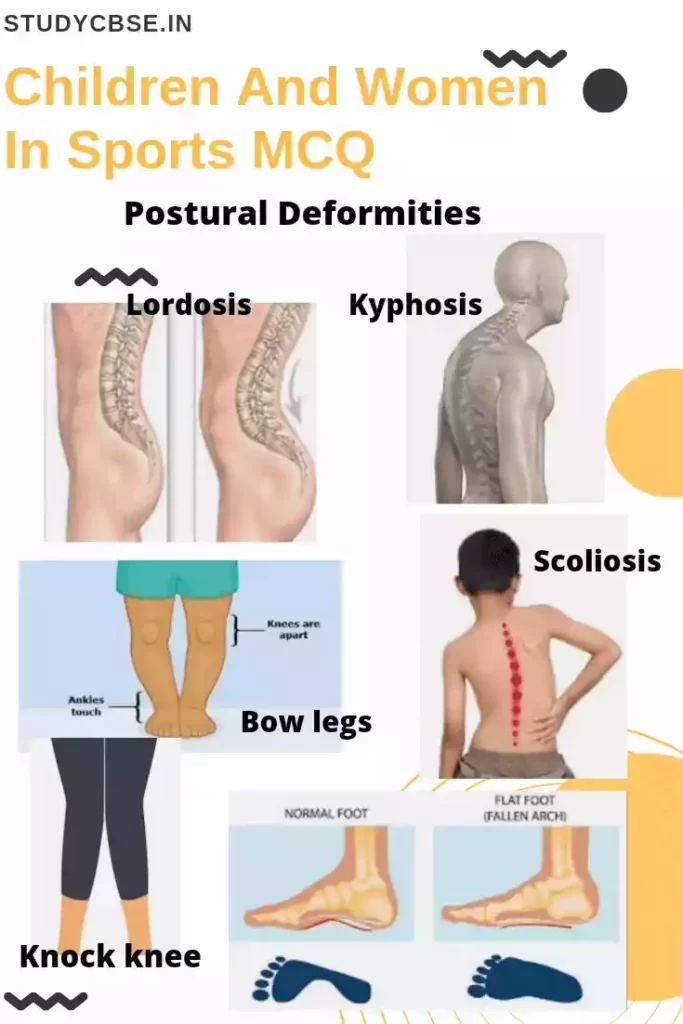 Children And Women In Sports MCQ postural deformities